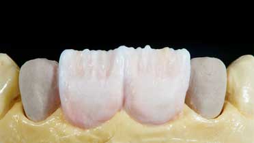 Что такое мамелоны?