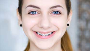 Глубокий прикус