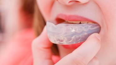 Как исправить кривые зубы без брекетов?