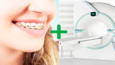 МРТ с брекетами