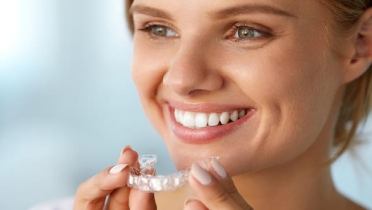 Съемные брекеты