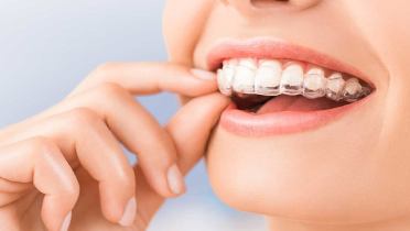 Уход за зубами после брекетов