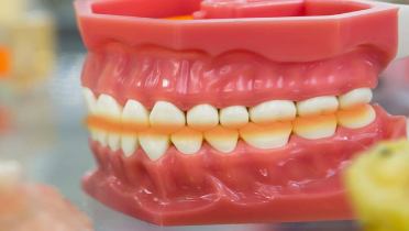 Истираемость зубов