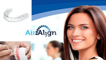 Особенности элайнеров Air Align.