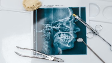 Мифы гнатологии в ортодонтии