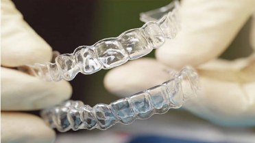 История появления и распространения элайнеров